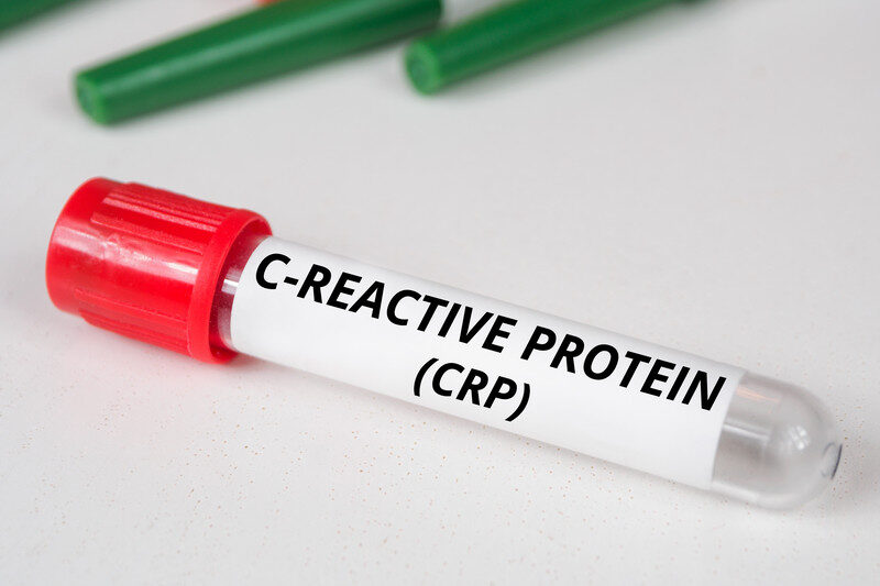 CRP Level